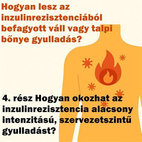 Födémkialakítás: fő koncepciók és összefüggések