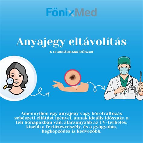 Hőingadozás és dilatációs terhelés ábrája