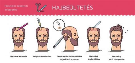 Infografika: hogyan működik a helyrajziszám-kereső