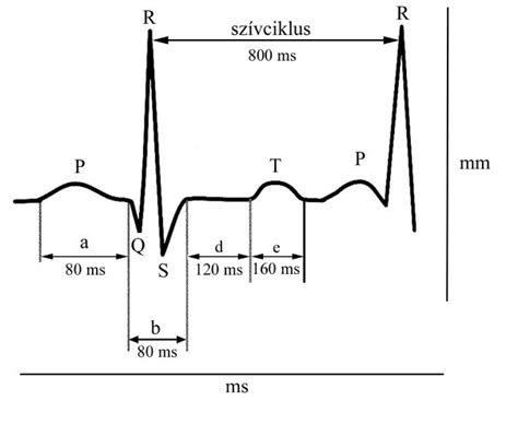 Cölöpalapozás vázlatos rajza